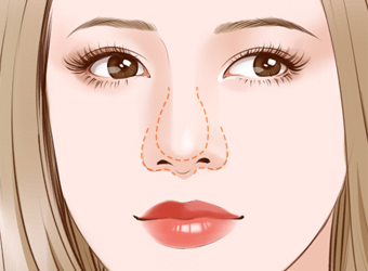 湖州超聲波去眼袋整形美容醫(yī)院排名揭曉！2023年比較推崇的湖州去眼袋醫(yī)院前十強+綜合口碑