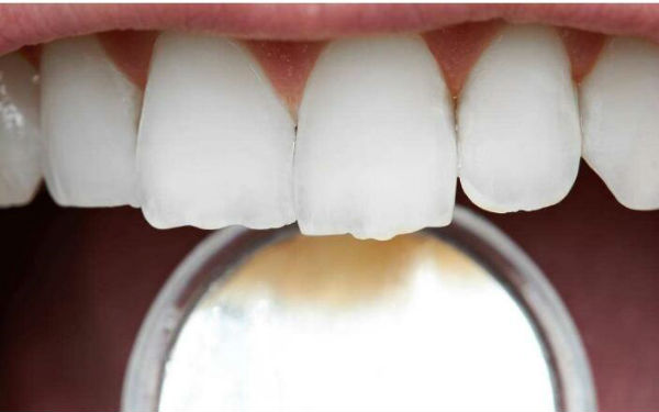 2023年哪家醫(yī)院在鎮(zhèn)江做水動力抽脂瘦腰效果比較好？TOP10整形醫(yī)院發(fā)布！