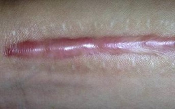 2023蘇州面部皺紋填充醫(yī)院排名揭曉！哪家醫(yī)院在皺紋填充領(lǐng)域名列前茅？