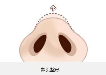 2023廈門注射豐耳垂術(shù)美容醫(yī)院前10強(qiáng)榜盤點(diǎn)，哪家口碑比較好？