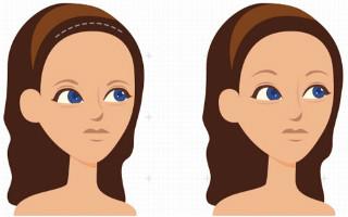 四川哪家醫(yī)院點陣激光去痘印口碑更佳？2023年四川點陣激光去痘印醫(yī)療整形醫(yī)院前十強榜單發(fā)布！