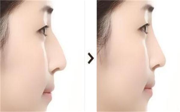 2023年中回顧！阜陽注射祛疤痕領(lǐng)域權(quán)威整形美容醫(yī)院排行榜TOP10強(qiáng)揭曉！