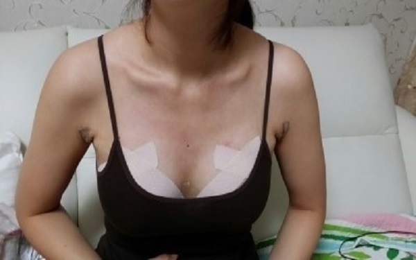 2023年北京注射脂肪隆胸醫(yī)院排名top10，讓你不再為選擇糾結(jié)！