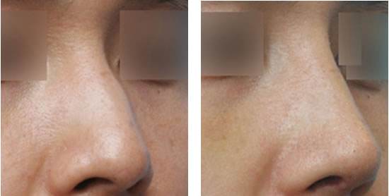 長沙法令紋填充，2023年10家美容醫(yī)院排名榜單發(fā)布