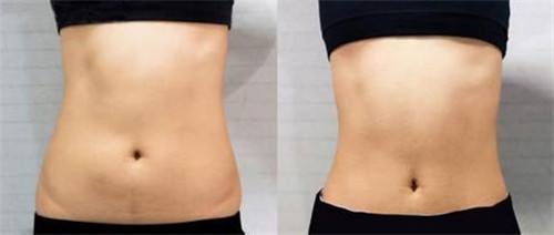 非常受歡迎的眼鼻部微創(chuàng)整形醫(yī)院推薦-2023年深圳前10名更新！