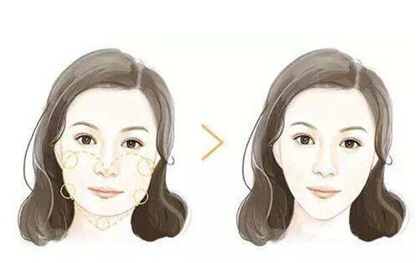 南京哪家整形醫(yī)院能有效去除面部皺紋？2023年南京治療面部皺紋醫(yī)院排名前10強！