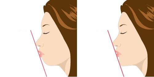 2023鄭州哪家口碑不錯(cuò)的切開(kāi)填充去痘疤整形美容醫(yī)院排行榜發(fā)布，前10強(qiáng)揭曉！