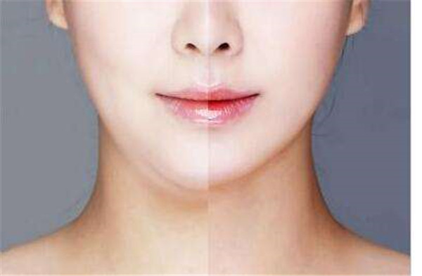 南京哪里可以做眉間紋注射填充手術？2023年南京眉間紋注射填充醫(yī)院實力排行榜發(fā)布！前十家醫(yī)療整形機構評測