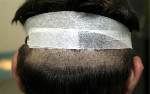 重慶哪家醫(yī)院豐唇口碑好？2023年榜單前十大整形美容醫(yī)院推薦！