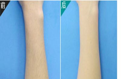 2023年西安陰道緊縮術(shù)修補(bǔ)醫(yī)院推薦TOP10強(qiáng)熱門評分揭曉！