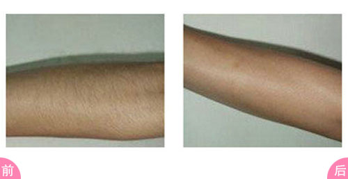 2023蘇州祛頸紋哪家醫(yī)院好？口碑比較好的10所整形醫(yī)院更新！