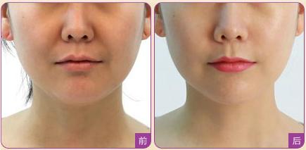 上海眉間紋醫(yī)療整形醫(yī)院強(qiáng)榜前10，選取眉間紋正規(guī)醫(yī)院指南