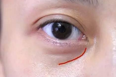 合肥去唇紋哪家醫(yī)院靠譜？2023年合肥十大專業(yè)去唇紋美容醫(yī)院介紹更新！