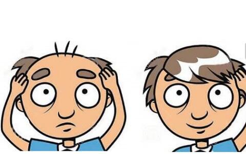 2023株洲眼紋肉毒素注射榜單揭曉！排名TOP10的正規(guī)醫(yī)院值得信賴！