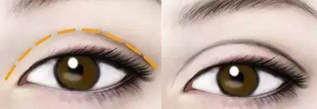 西安哪家醫(yī)院是比較好的雙眼皮下垂提拉整形美容醫(yī)院？2023年西安雙眼皮下垂提拉醫(yī)療整形醫(yī)院前10名推薦！