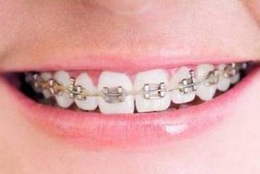 2023石家莊比較推崇的無痕翹睫法雙眼皮整形醫(yī)院最新排行榜來襲！石家莊無痕翹睫法雙眼皮權(quán)威專家醫(yī)院排名揭