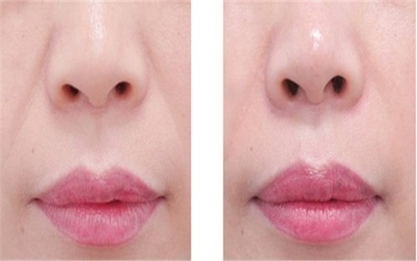 揭秘2023年海南十大專業(yè)除眼紋醫(yī)療美容醫(yī)院，哪些值得考慮！