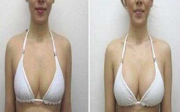 2023太原水光針去除色素沉重醫(yī)院TOP10，看看這些行之有效的整容美容醫(yī)院！