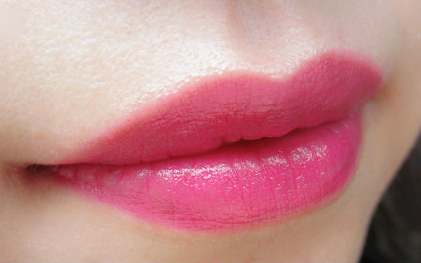 2023上海很受歡迎的射頻吸脂瘦肩部整形醫(yī)院排行榜公布！看看哪些醫(yī)院值得選擇