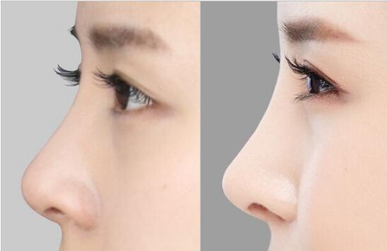 西安哪家醫(yī)院的手術祛除眉間紋效果比較好？2023西安一流美容醫(yī)院推薦top10！