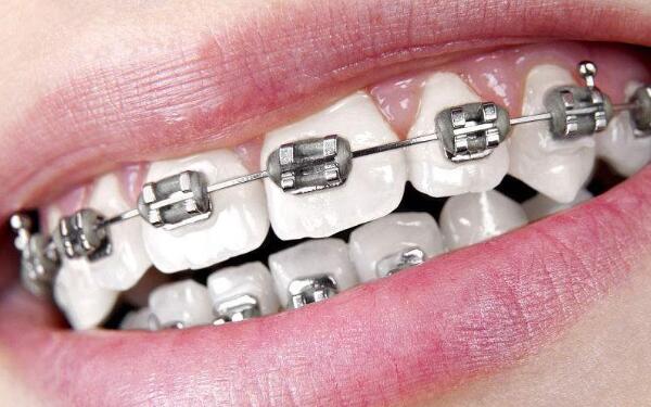 2023年北京微晶祛雀斑美容醫(yī)院排名前十，哪幾家值得去？