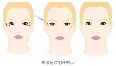 2023年北京鼻端缺損整形美容醫(yī)院前十強排名揭曉！知名度爆棚的醫(yī)療機構(gòu)盤點！