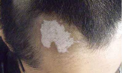 南寧哪家醫(yī)院除皺效果好？2023年排名前10強的正規(guī)醫(yī)院盤點！