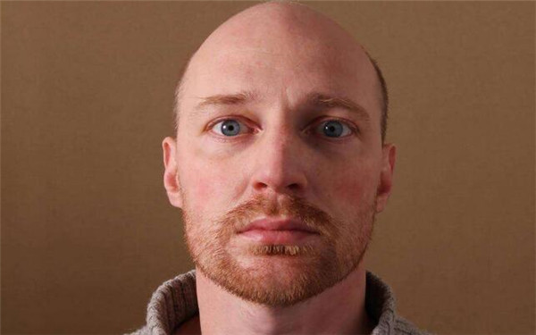 2023年舟山韓式開眼角手術(shù)醫(yī)院推薦，口碑爆棚的前10家醫(yī)院盤點(diǎn)！