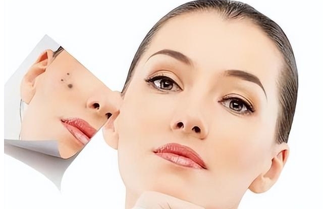 2023昆明哪家整形美容醫(yī)院面部去痣口碑比較好？評分10強(qiáng)你知道嗎？