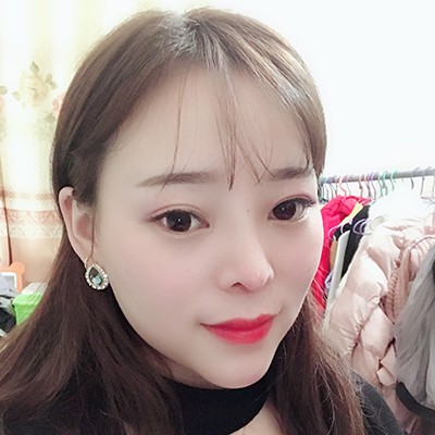 術(shù)前矮低平，術(shù)后高挺翹~肋軟骨隆鼻效果好的不得了！