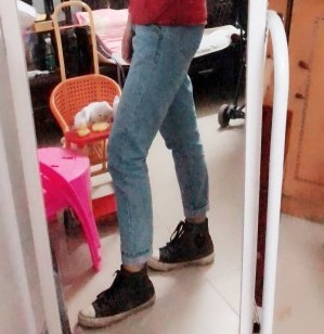 胖腿女孩兒福利分享：吸脂瘦大腿的蛻變，效果值得點贊！