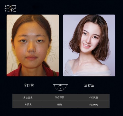 阿爾法9°美眼，打開(kāi)視界，美無(wú)止境