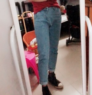 胖腿女孩兒福利分享：吸脂瘦大腿的蛻變，效果值得點贊！