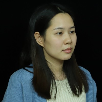 記錄我在廣州韓妃整形美容醫(yī)院眼綜合的手術(shù)經(jīng)歷，還有前后對比照片~