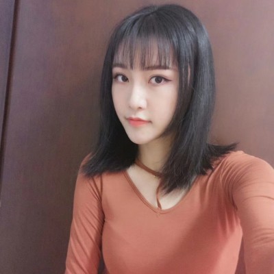 眼綜合術(shù)前VS術(shù)后，自然大眼睛值得稱贊！