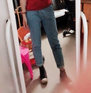 胖腿女孩兒福利分享：吸脂瘦大腿的蛻變，效果值得點贊！