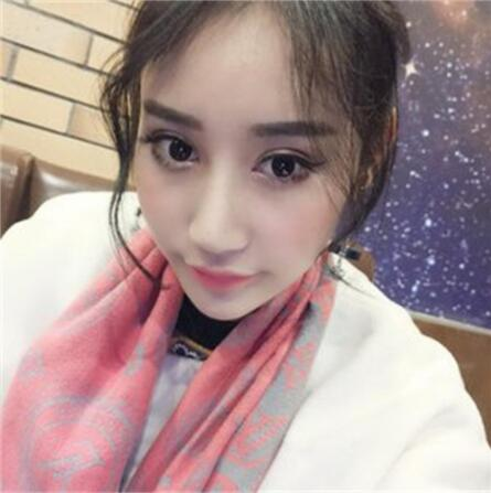 雙眼皮失敗丑的不敢見(jiàn)人，昆明麗都整形雙眼皮修復(fù)案例分享