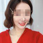 杭州國雅口腔隱形矯正案例分享，有這么好看的牙就要多笑笑