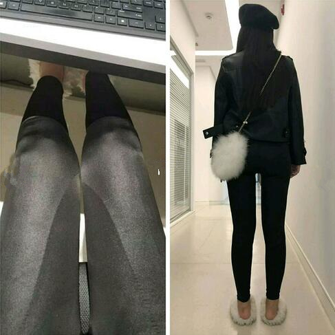 成都趙博士整形大腿吸脂案例半年效果