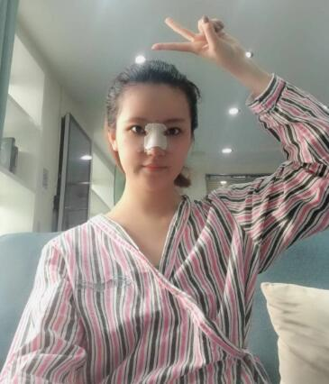 北京葉子整形肋軟骨隆鼻案例反饋，這鼻子是真實存在的嗎