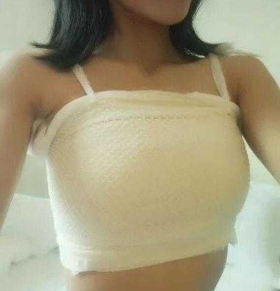 吉安第二醫(yī)院妙桃假體隆胸案例術(shù)后第三天效果 吉安第二醫(yī)院妙桃假體隆胸案例術(shù)后第三天效果