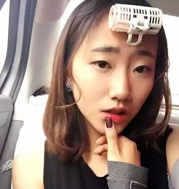 武漢藝星整形岳金堂醫(yī)生雙眼皮案例術(shù)后三個(gè)月效果反饋