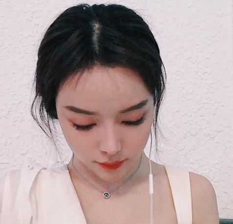 廈門新生植發(fā)種植發(fā)際線三個(gè)月