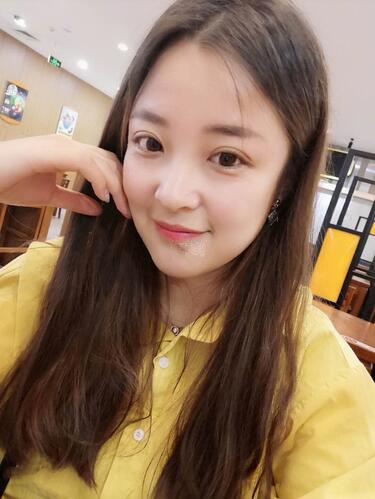 西安時光整形郭淑華雙眼皮案例術后一個月