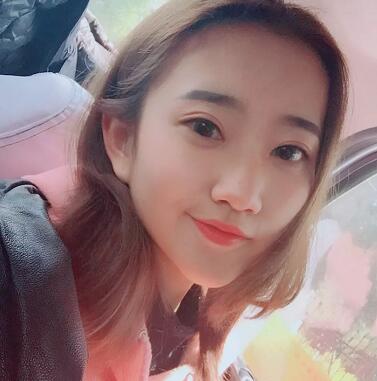 武漢藝星整形岳金堂醫(yī)生雙眼皮案例術(shù)后三個(gè)月