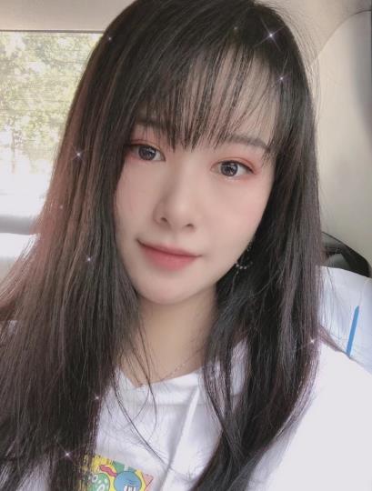 南方醫(yī)院整形美容科顴骨內(nèi)推一個月 南方醫(yī)院整形美容科顴骨內(nèi)推一個月