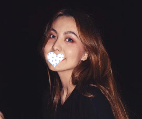 徐州時光洪揚整形雙眼皮術(shù)后三個月效果 徐州時光洪揚整形雙眼皮術(shù)后三個月效果