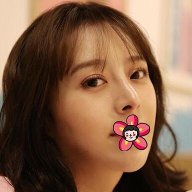 北京基礎美下頜角整形案例效果分享，黃大勇果然名不虛傳