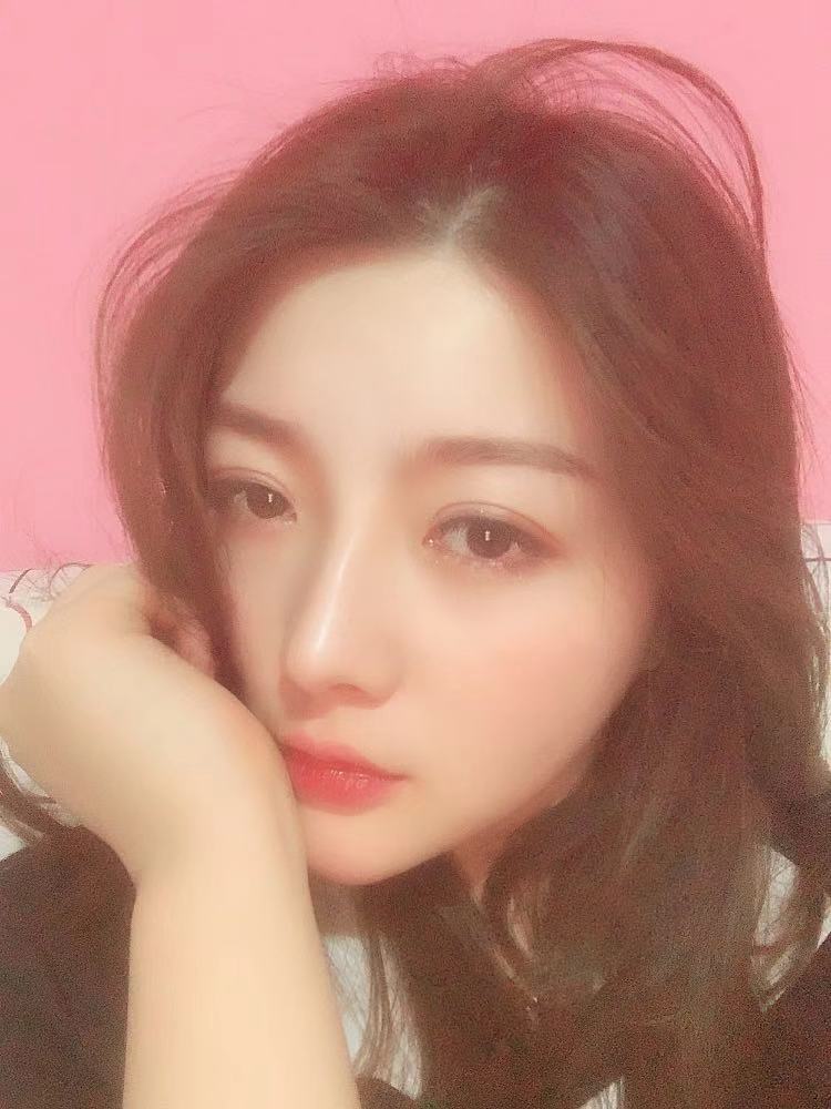 北京圣嘉榮二次鼻修復(fù)術(shù)后兩個(gè)月 北京圣嘉榮二次鼻修復(fù)術(shù)后兩個(gè)月