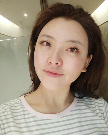 上海首爾麗格樸興植下頜角整形一個(gè)月 上海首爾麗格樸興植下頜角整形一個(gè)月